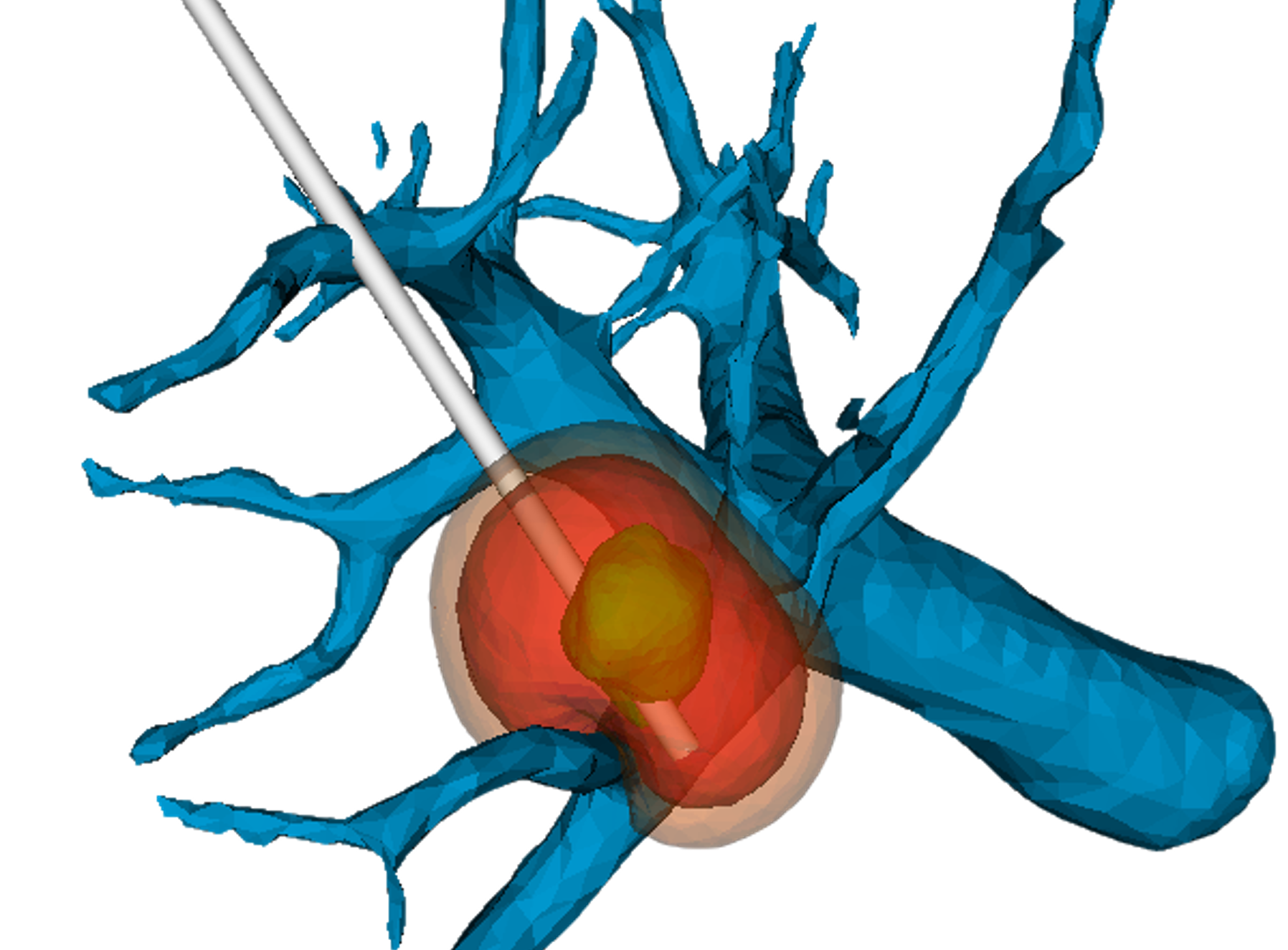 Simulation of ablation